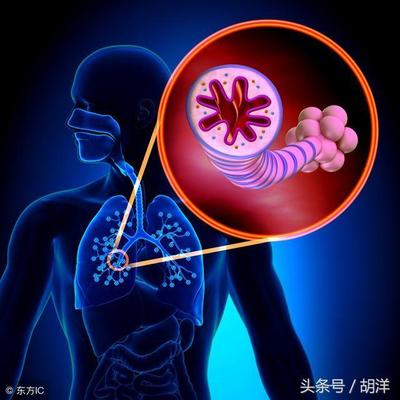 咳嗽咳出血了是怎么回事严重吗