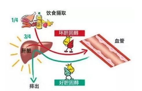 胆固醇高是怎么回事