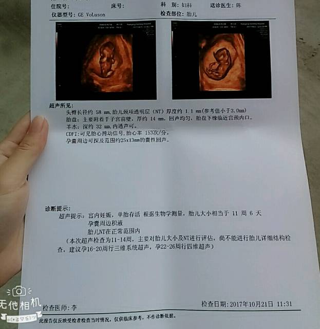 胎儿10周有多大