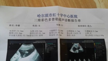 怀孕了怎么看男女
