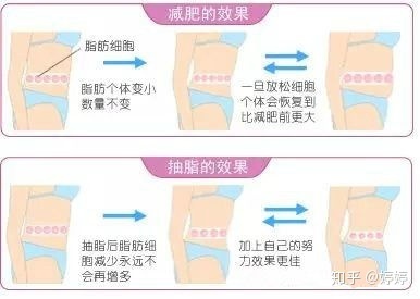 抽脂的危害