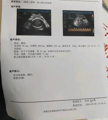 31周胎儿一般多重