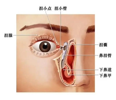 眼睛泪管堵塞怎么治疗