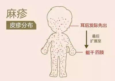 孕妇初期症状