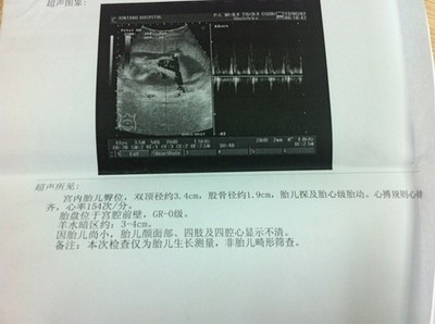 胎儿心跳是什么声音