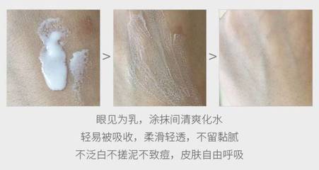 夏季痘痘皮肤用什么水