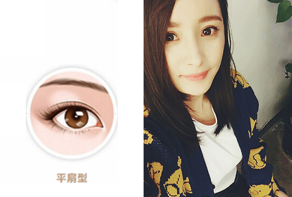 美丽的双眼皮
