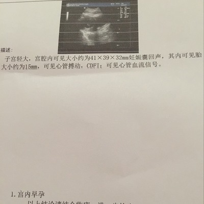 怀孕3个月孕囊多大
