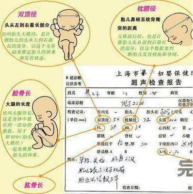 怎么测试男女宝宝最准