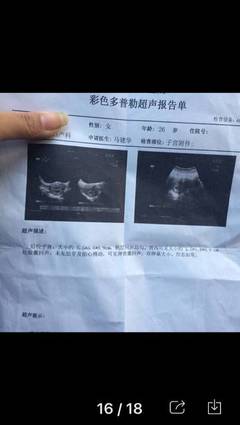 怀孕14周宝宝有多大