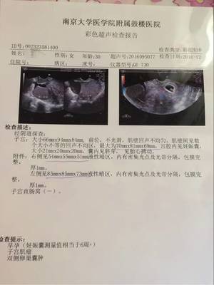 人流一次还能怀孕吗