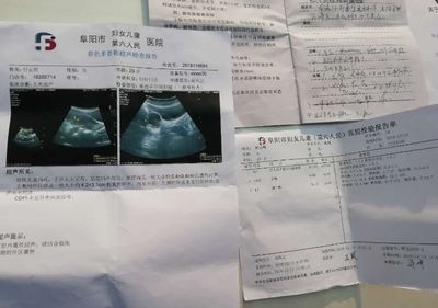 怀孕出血量