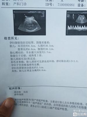 孕妇肾盂分离是什么意思