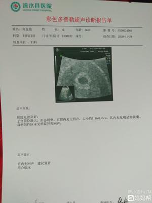 怀孕四十天彩超图片