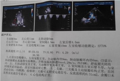 孕妇需要做心脏彩超吗