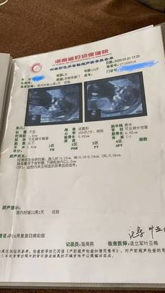 怀孕多久抽血可以检查出来