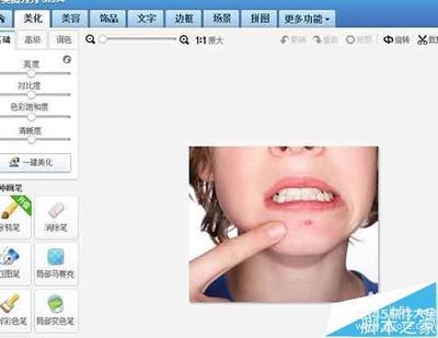 照片中的痘痘去掉吗