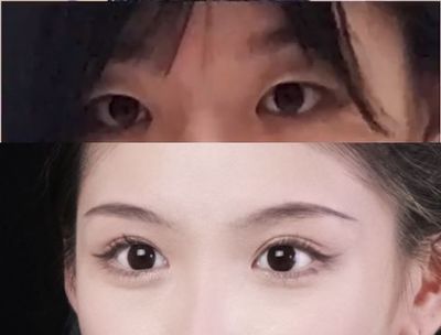 割双眼皮好看吗