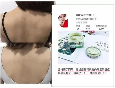 前胸长黑色的痘痘