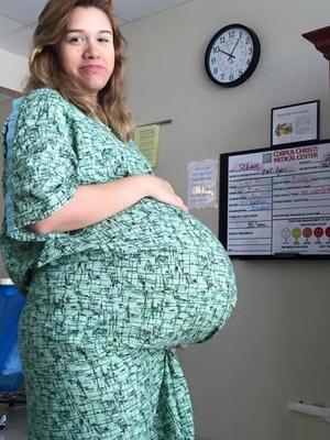 日大肚子孕妇