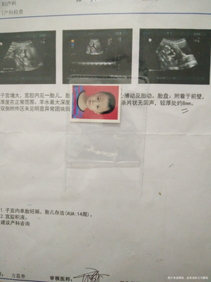 五个月胎动什么感觉