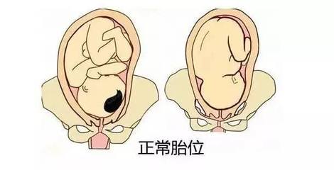 胎儿胎位什么时候固定