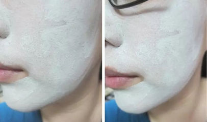 用爽肤水做面膜有什么效果