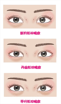 什么年龄双眼皮