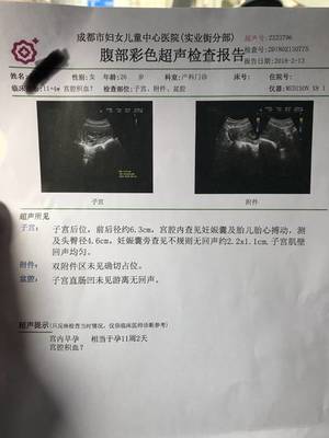 宫腔积血是怎么回事