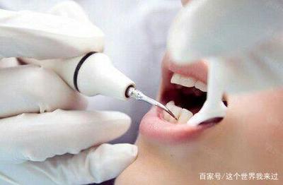 喷沙洗牙