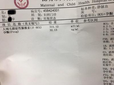 怀孕多久抽血可以检查出来