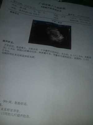 怀孕两个月流血了怎么办