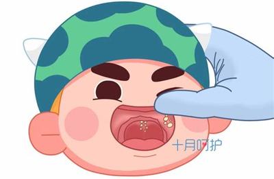 新生儿反胃