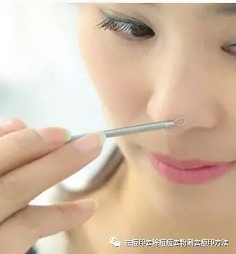 挤痘痘怎么护理
