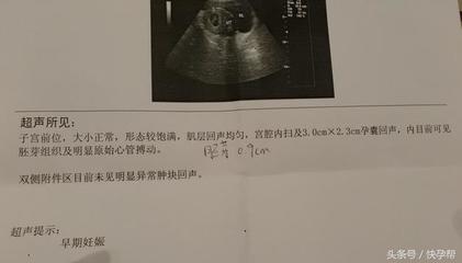怀孕50天有胎心吗