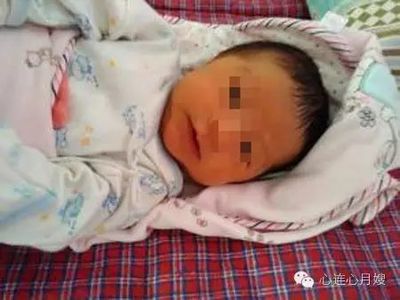 蚕豆病宝宝溶血的症状