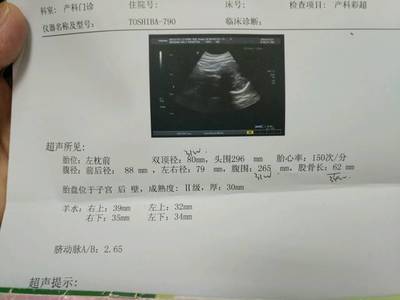 孕三十三周是几个月