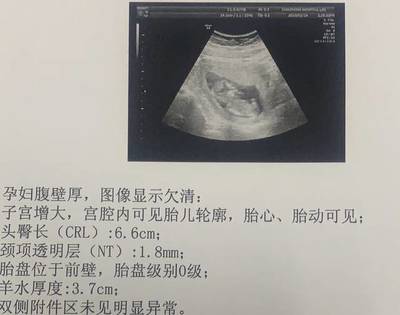 胎儿14周会有胎动吗