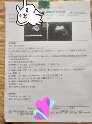 32周胎宝宝
