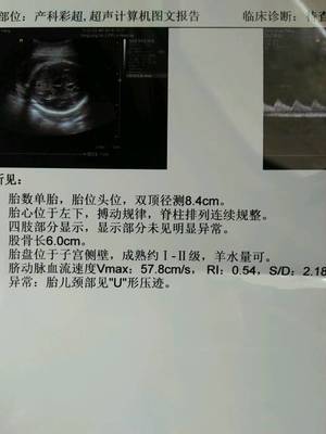32周胎宝宝