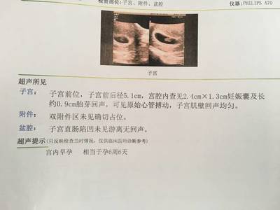 查白带可以查出怀孕吗