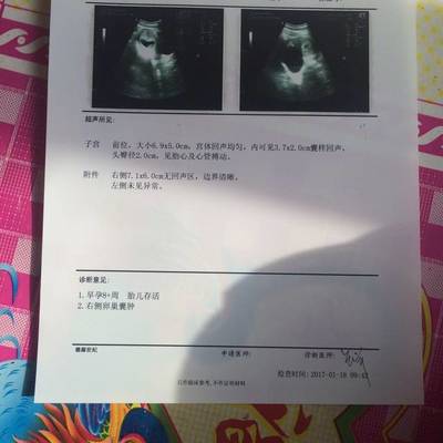 怀孕两个月小孩有多大