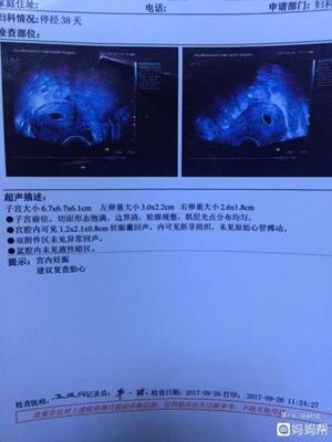 怀孕40天能看出男女吗