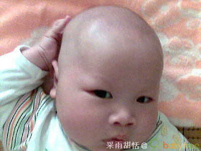三个月宝宝掉头发怎么回事