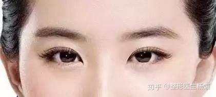 双眼皮有哪几种形状