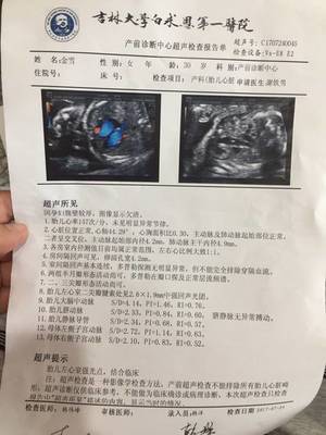 有必要做胎儿心脏彩超吗