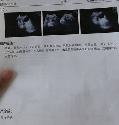查怀孕抽血