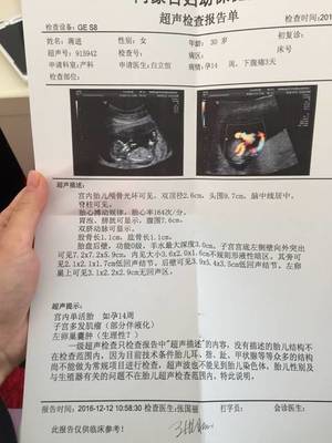 怀孕14周宝宝有多大