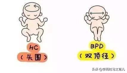 胎儿头小会影响智力吗