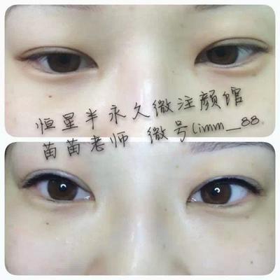广州纹眼线价格多少钱